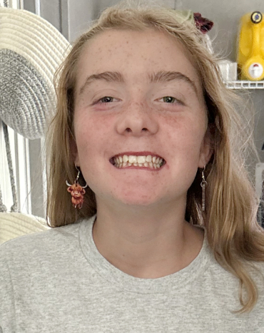 Haley - 13, F